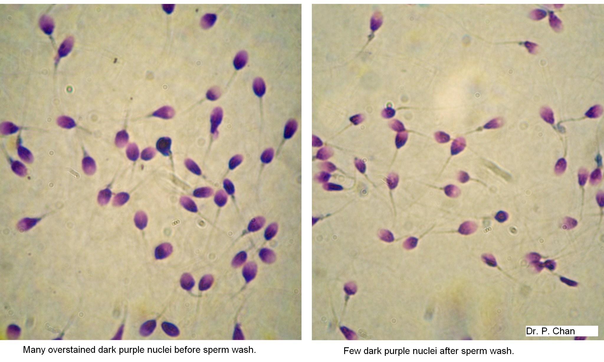 Fertility research image: sperm integrity