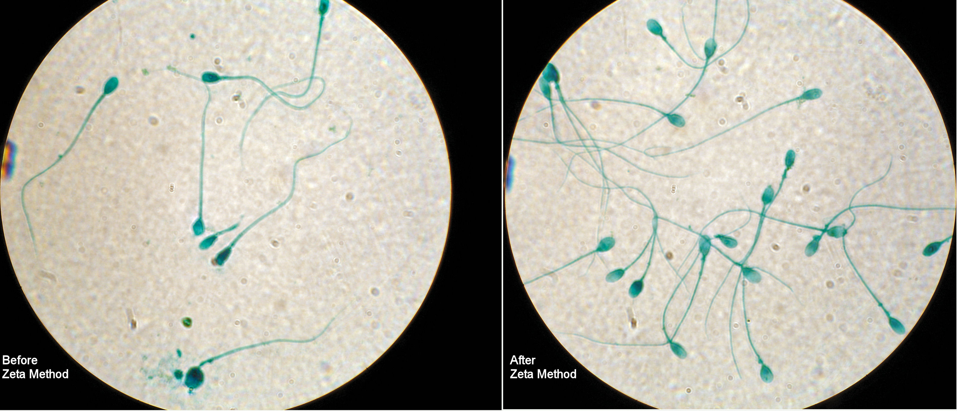 Menstrual Cycle Explained  Loma Linda University Fertility