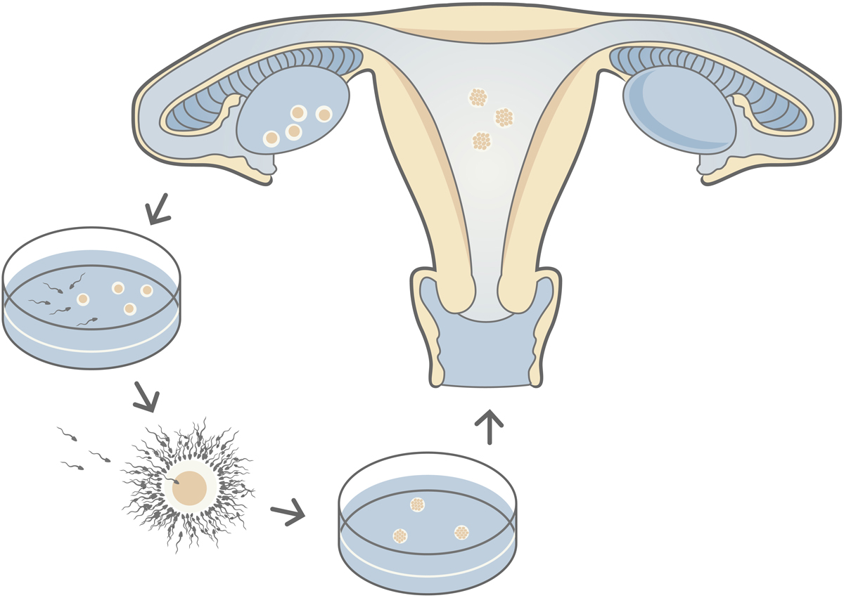 In Vitro Fertilization Ivf Loma Linda University Center For