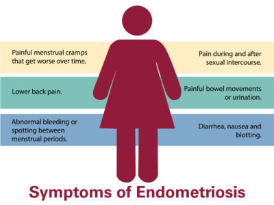 Symptoms of Endometriosis | Infographic by LLU Center for Fertility & IVF