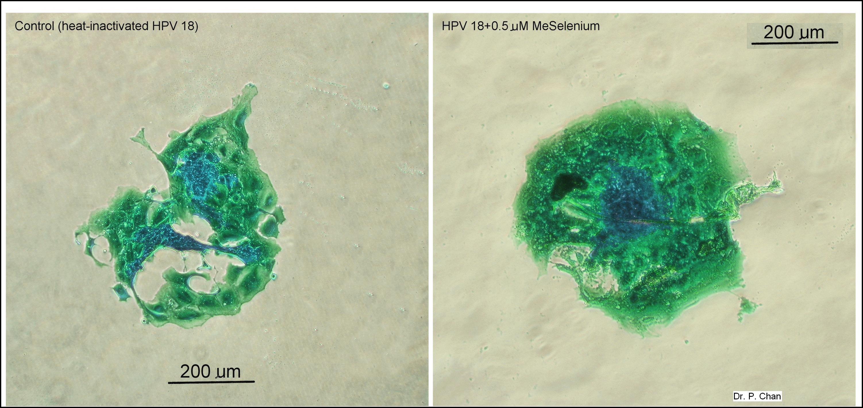 Selenium fertility research image