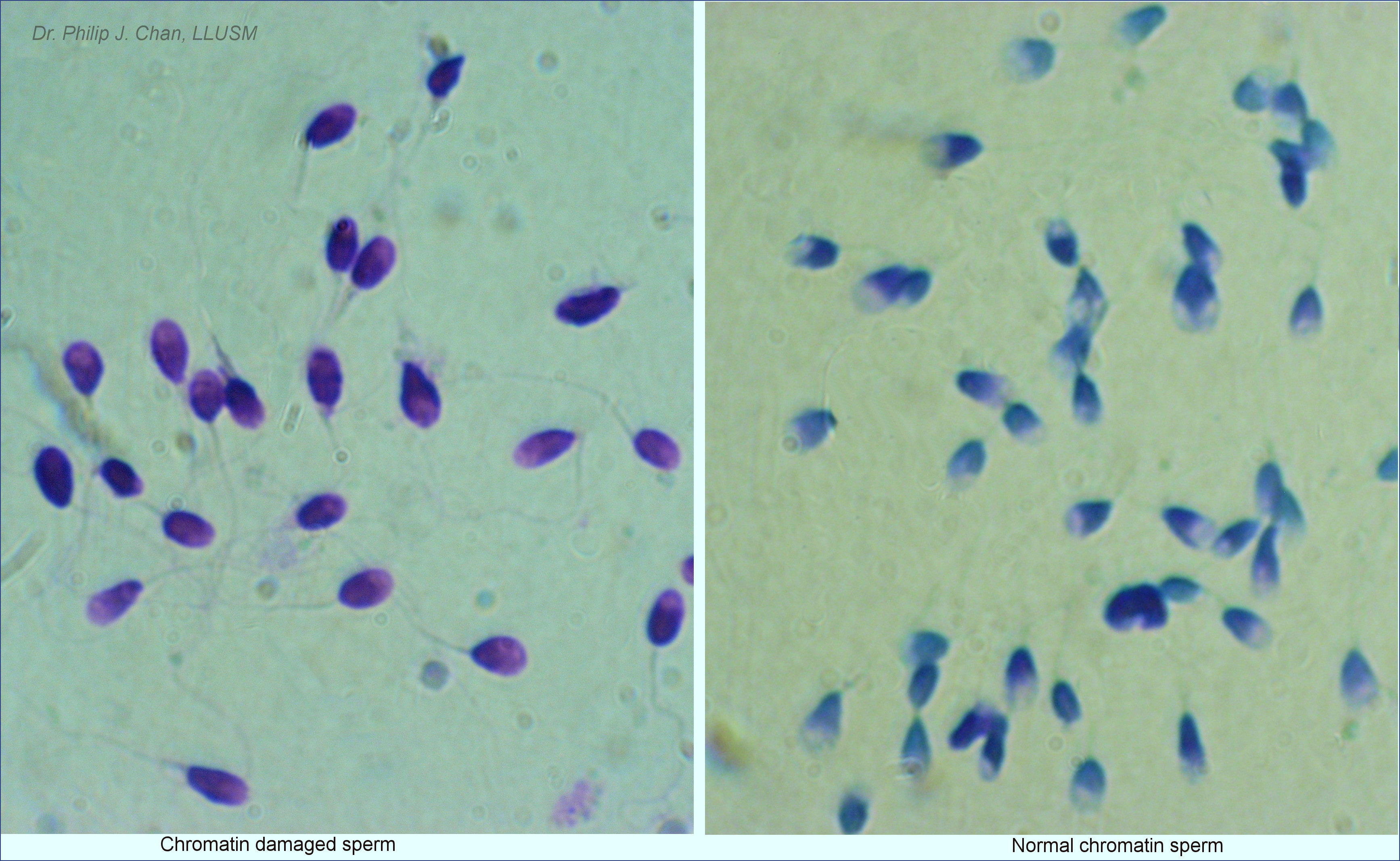 Fertility Research LLU Fertility