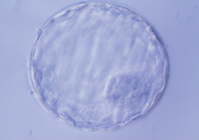 Top Quality Blastocyst Embryo