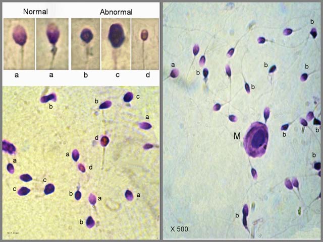 Andrology Lab at LLU Fertility