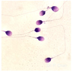 Sperm morphology | LLU Center for Fertility & IVF | Normal sperm