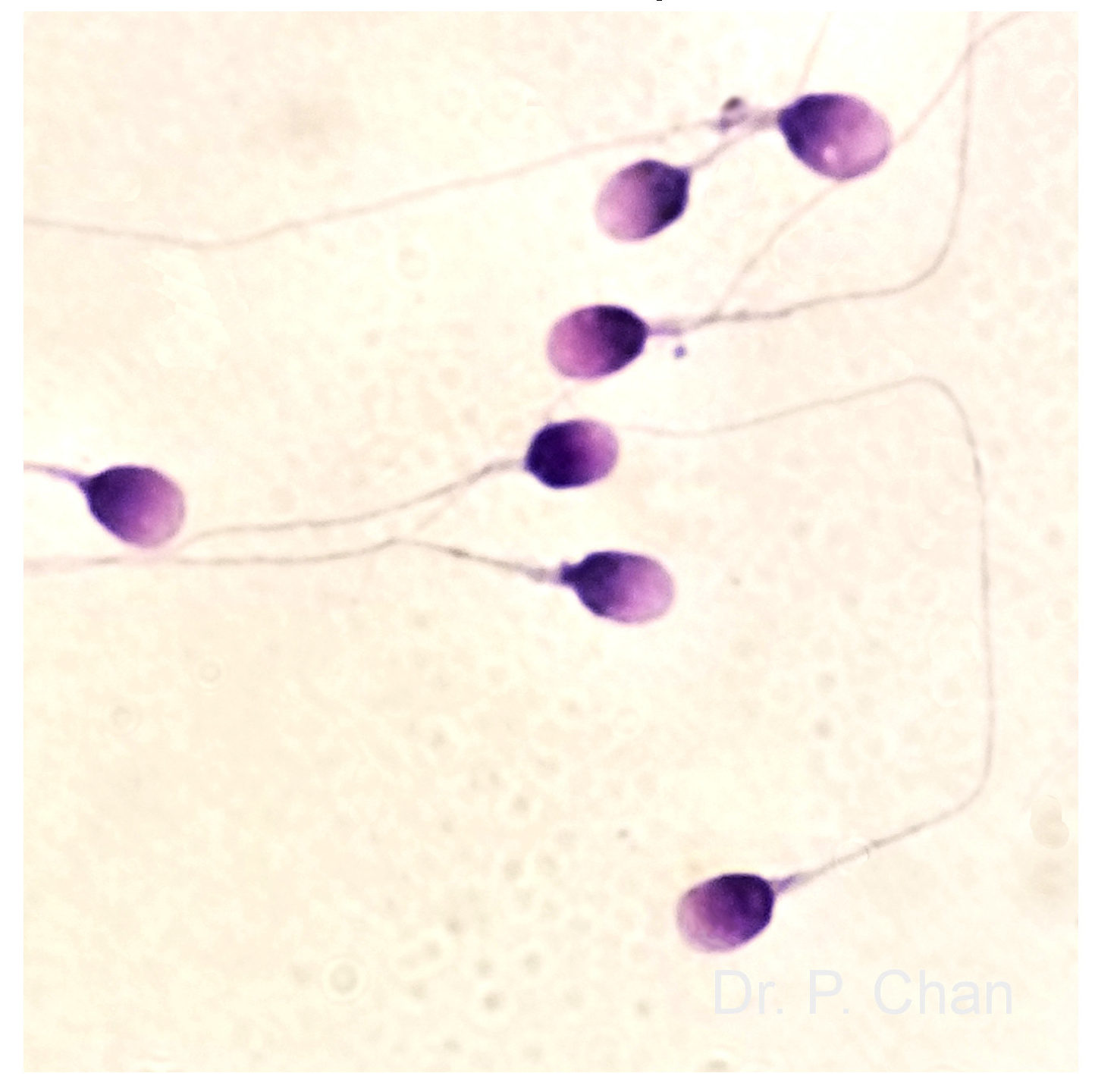 сперма во влагалище у детей фото 11